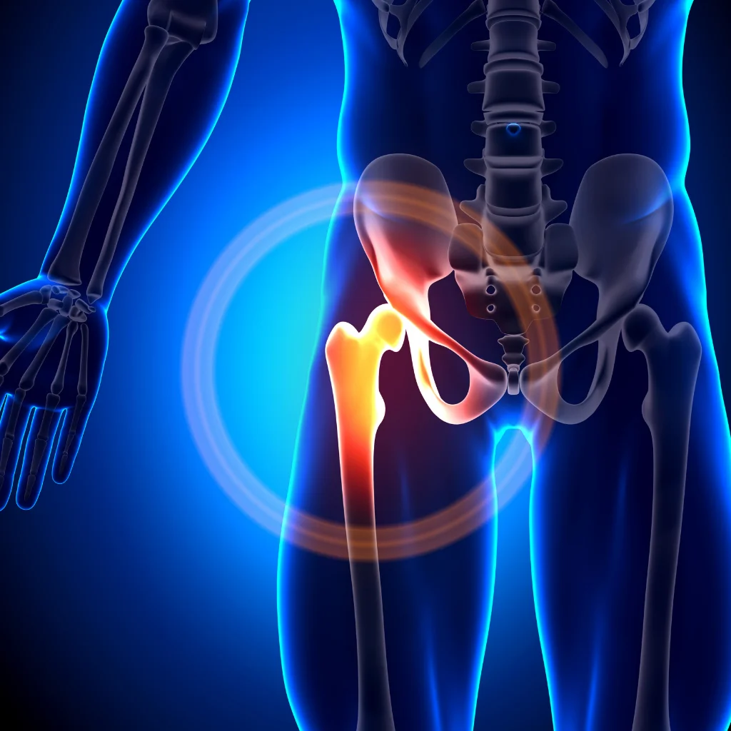Bone density photo for osteoporosis and osteopenia workshop at reformer pilates studio in Boulder, CO